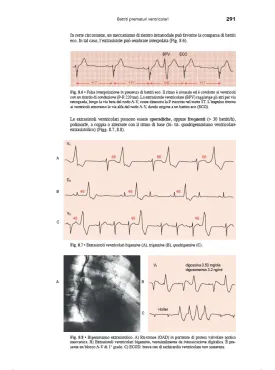 Le Aritmie Cardiache - Meccanismi, diagnosi e terapia