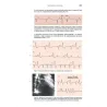 Le Aritmie Cardiache - Meccanismi, diagnosi e terapia