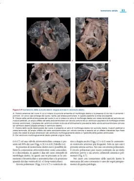 Cardiopatie congenite. Testo Atlante