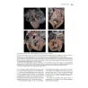 Cardiopatie congenite. Testo Atlante