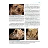 Cardiopatie congenite. Testo Atlante