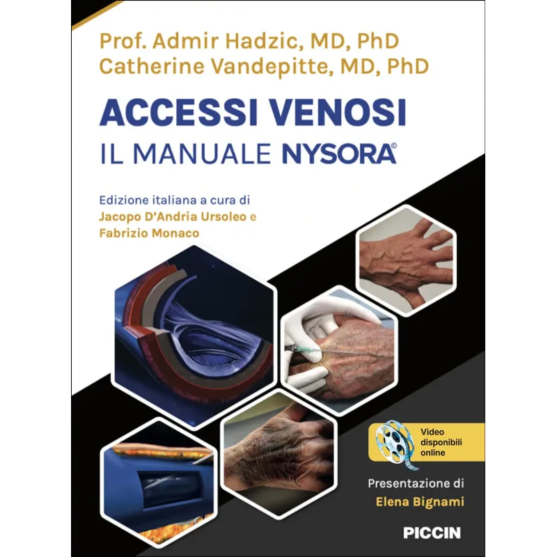 Accessi venosi – Il manuale Nysora©