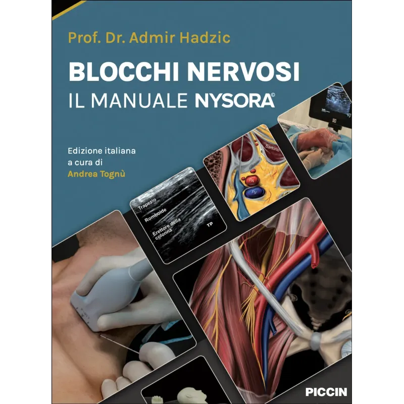 Blocchi nervosi – Il manuale Nysora©