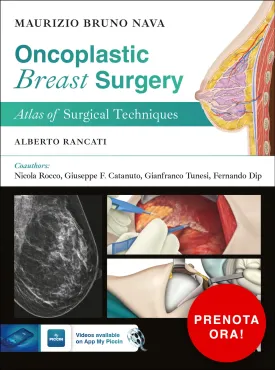 Oncoplastic Breast Surgery. Atlas of Surgical Techniques