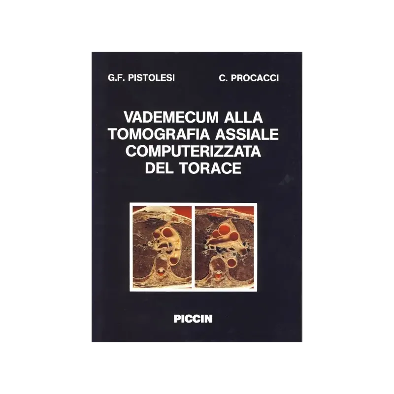 Vademecum alla tomografia assiale computerizzata del torace