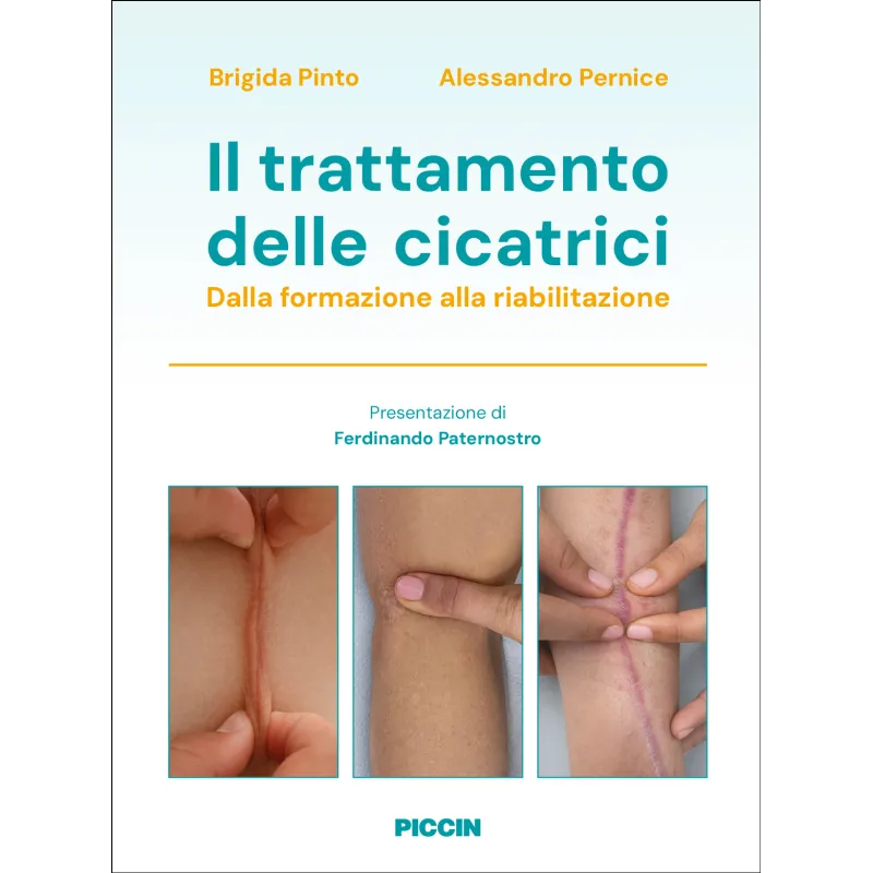 Il trattamento delle cicatrici