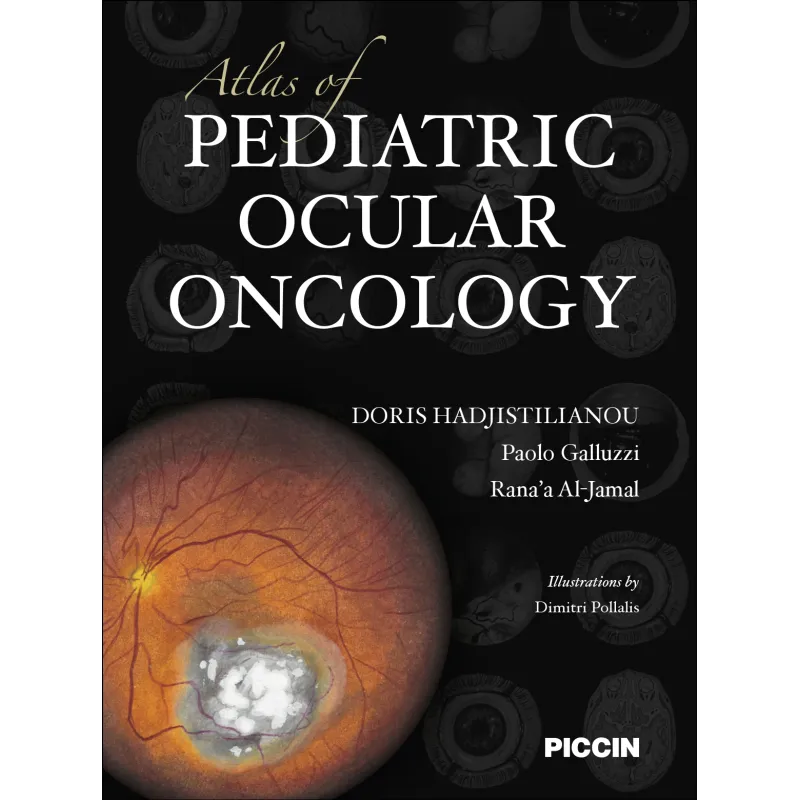 Atlas of Pediatric Ocular Oncology