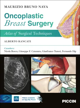 Oncoplastic Breast Surgery. Atlas of Surgical Techniques