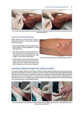 Accessi venosi – Il manuale Nysora©