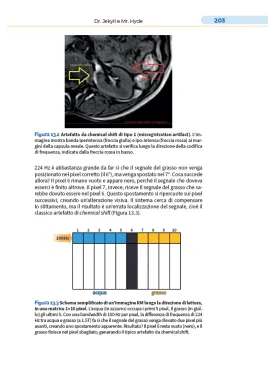 Il tuo primo libro di risonanza magnetica