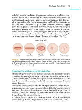 Il trattamento delle cicatrici