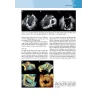 Ecocardiografia clinica