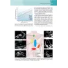 Ecocardiografia clinica