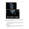Guida tascabile di Ecografia in medicina interna