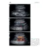 Guida tascabile di Ecografia in medicina interna