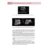 Nefrologia pediatrica