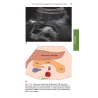 TASCABILE DI ECOGRAFIA ADDOMINALE Anatomia e protocolli