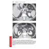 TASCABILE DI ECOGRAFIA ADDOMINALE Anatomia e protocolli
