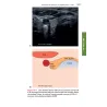 TASCABILE DI ECOGRAFIA ADDOMINALE Anatomia e protocolli