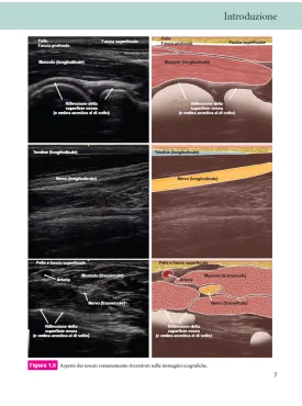 Anatomia ecografica – L’essenziale