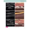Anatomia ecografica – L’essenziale