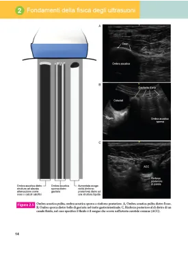 Anatomia ecografica – L’essenziale