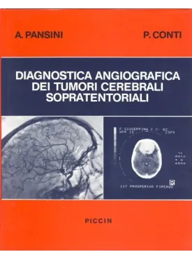 Diagnostica angiografica dei tumori cerebrali sopra-tentoriali