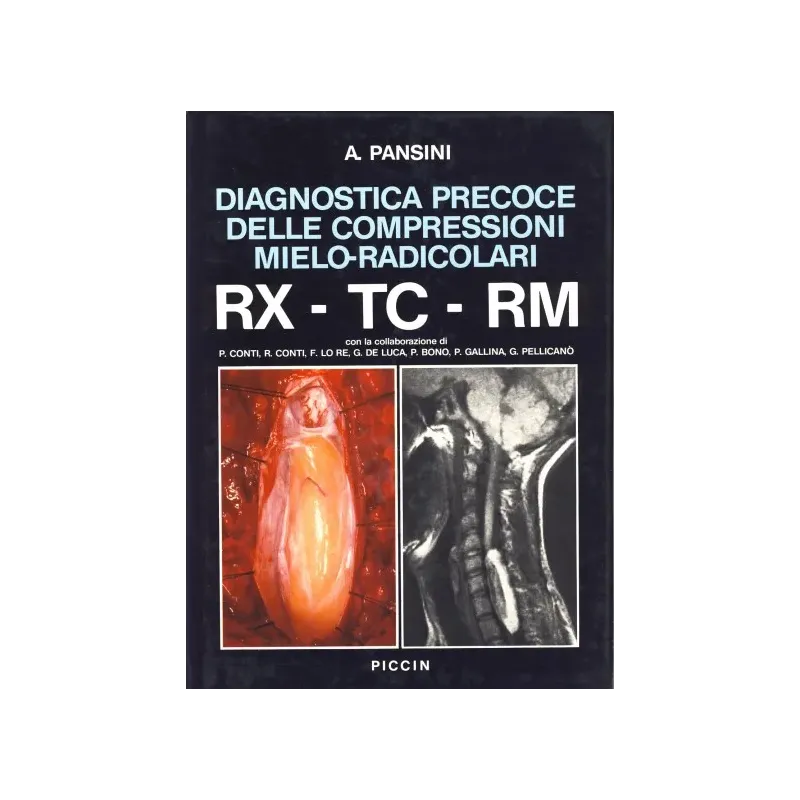Diagnostica precoce delle compressioni mielo-radicolari RX-TC-RM