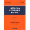 L'ischemia cerebrale focale