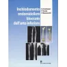 Inchiodamento endomidollare bloccato dell'arto inferiore