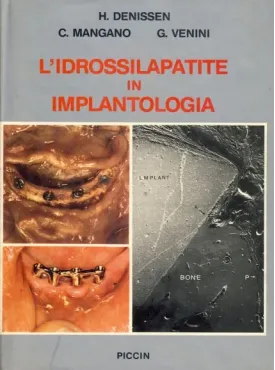 L'Idrossilapatite in Implantologia