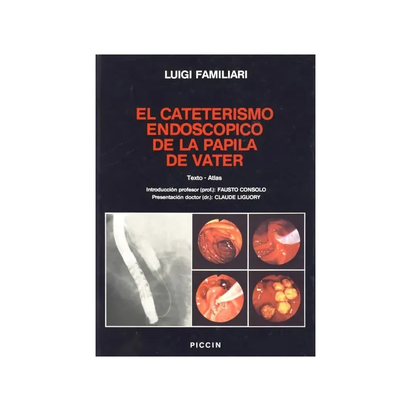 EL CATETERISMO ENDOSCOPICO DE LA PAPILA DE VATER