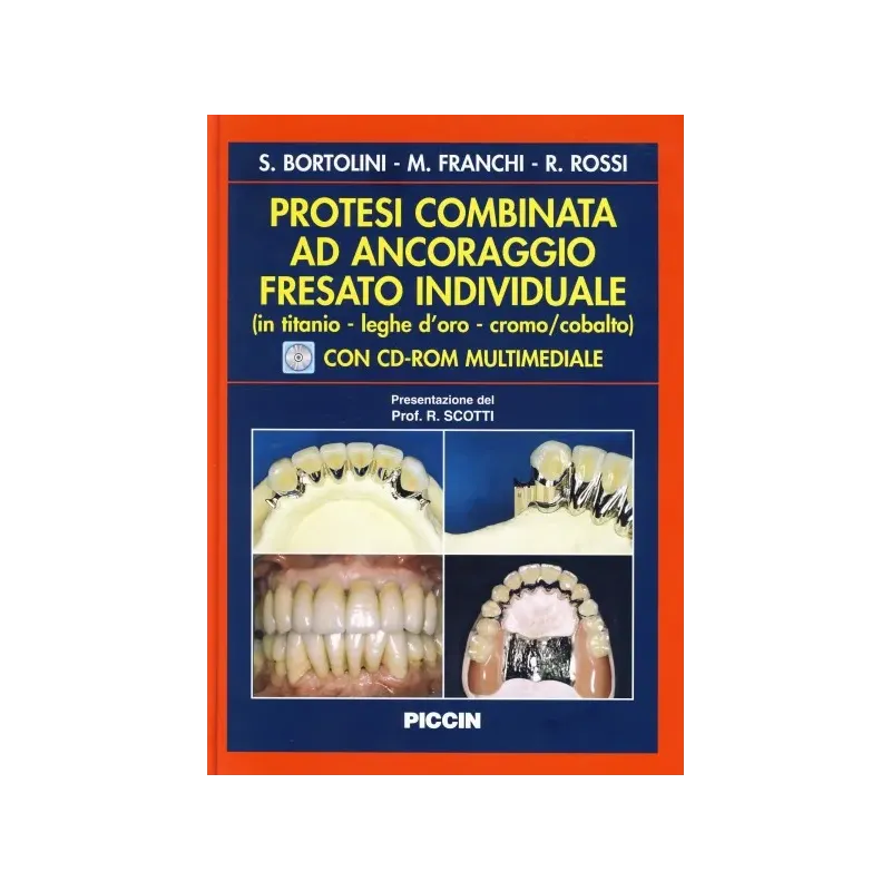 Protesi Combinata ad Ancoraggio Fresato Individuale