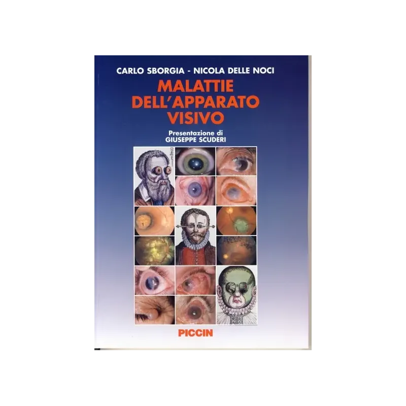 Malattie dell'Apparato Visivo