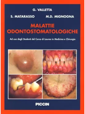 Malattie Odontostomatologiche