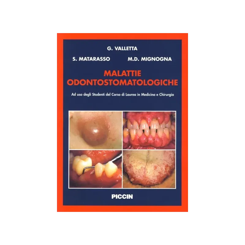 Malattie Odontostomatologiche